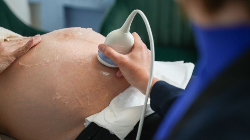 71fab01a128f166696a7af54c8aa6ee2a588abe5 2